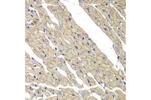Immunohistochemistry of paraffin-embedded rat heart using SGCD antibody.