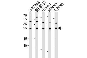 Western blot analysis of lysates from U-87 MG, SH-SY5Y cell line, human brain, mouse brain, rat brain tissue lysate (from left to right), using STMN2 Antibody (N-term) (ABIN6243305 and ABIN6577588).