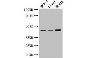 Western Blot Positive WB detected in: MCF-7 whole cell lysate, Mouse liver tissue, Mouse brain tissue All lanes: KCNJ11 antibody at 3 μg/mL Secondary Goat polyclonal to rabbit IgG at 1/50000 dilution Predicted band size: 44, 34 kDa Observed band size: 44 kDa