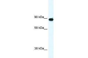 WB Suggested Anti-GRM6 Antibody Titration:  0. (Metabotropic Glutamate Receptor 6 anticorps  (C-Term))