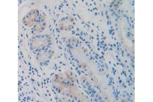IHC-P analysis of Human Tissue, with DAB staining. (CKB anticorps  (AA 11-367))
