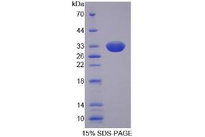 SDS-PAGE analysis of Human SLC22A11 Protein. (SLC22A11 Protéine)