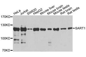 Western blot analysis of extracts of various cell lines, using SART1 antibody (ABIN5996293) at 1/1000 dilution. (SART1 anticorps)
