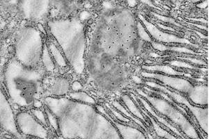 Immunoelectron microscopy analysis of LR white resin-embedded mouse pancreas using HSP60 (ABIN7074167) at dilution of 1: 50.
