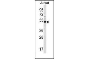 anti-Family with Sequence Similarity 8, Member A1 (FAM8A1) (AA 94-133), (N-Term) antibody