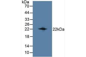 Detection of LCN8 in Mouse Testis Tissue using Polyclonal Antibody to Lipocalin 8 (LCN8) (LCN8 anticorps  (AA 27-176))
