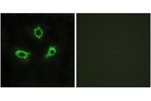 Immunofluorescence analysis of LOVO cells, using GPR115 Antibody. (G Protein-Coupled Receptor 115 anticorps  (AA 641-690))