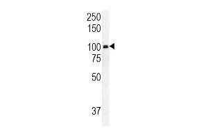 RASGRP1 Antibody (Center) (ABIN652037 and ABIN2840511) western blot analysis in HepG2 cell line lysates (35 μg/lane).