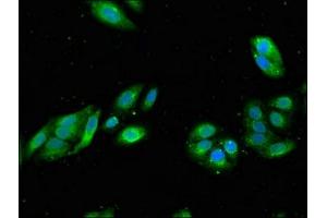 Immunofluorescent analysis of HepG2 cells using ABIN7167597 at dilution of 1:100 and Alexa Fluor 488-congugated AffiniPure Goat Anti-Rabbit IgG(H+L)