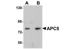 Western blot analysis of APC5 in human kidney tissue lysate with AP30061PU-N APC5 antibody at (A) 1 and (B) 2 μg/ml. (ANAPC5 anticorps  (Center))