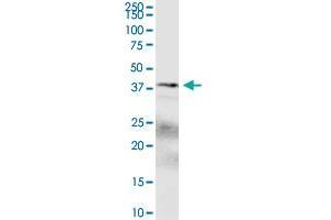 SPDEF polyclonal antibody (A01).