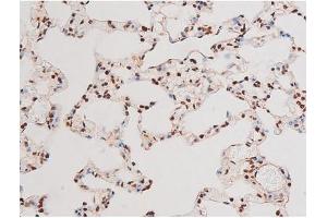ABIN6267601 at 1/200 staining Rat lung tissue sections by IHC-P.