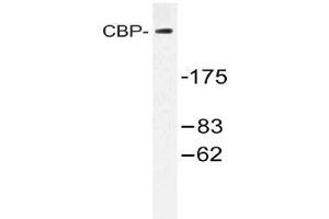 Western blot (WB) analysis of CBP antibody in extracts from HT-29 cells treated with calyculinA 50ng. (CBP anticorps)