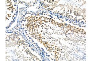 anti-serine/threonine Kinase 36 (STK36) (Internal Region) antibody