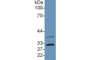Detection of C1QBP in Human Hela cell lysate using Monoclonal Antibody to Complement component 1 Q subcomponent-binding protein, mitochondrial (C1QBP)