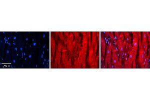 Rabbit Anti-TXN Antibody Catalog Number: ARP72618_P050 Formalin Fixed Paraffin Embedded Tissue: Human heart Tissue Observed Staining: Cytoplasmic near intercalated discs Primary Antibody Concentration: 1:100 Other Working Concentrations: N/A Secondary Antibody: Donkey anti-Rabbit-Cy3 Secondary Antibody Concentration: 1:200 Magnification: 20X Exposure Time: 0.