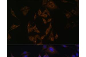 Immunofluorescence analysis of HeLa cells using UBE2L6 Polyclonal Antibody at dilution of 1:100.