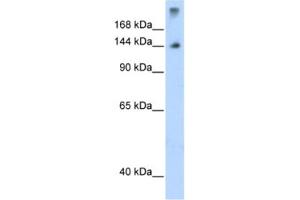 Western Blotting (WB) image for anti-Splicing Factor 3b, Subunit 1, 155kDa (SF3B1) antibody (ABIN2462069) (SF3B1 anticorps)