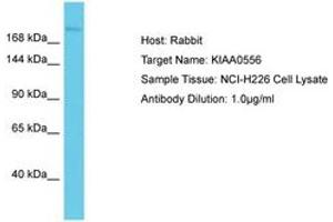 Image no. 1 for anti-KIAA0556 (KIAA0556) (AA 142-191) antibody (ABIN6750570) (KIAA0556 anticorps  (AA 142-191))