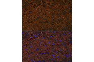 Immunofluorescence analysis of rat brain cells using TMOD2 Rabbit mAb (ABIN7271011) at dilution of 1:100 (40x lens).