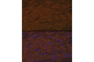 Immunofluorescence analysis of rat brain cells using TMOD2 Rabbit mAb (ABIN7271011) at dilution of 1:100 (40x lens). (TMOD2 anticorps)