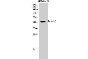 Western Blotting (WB) image for anti-Actin, alpha 1, Skeletal Muscle (ACTA1) (N-Term) antibody (ABIN3183158)