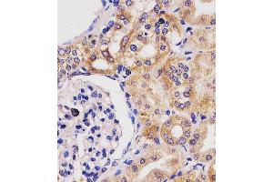 (ABIN6243842 and ABIN6577230) staining GLS2 in human kidney tissue sections by Immunohistochemistry (IHC-P - paraformaldehyde-fixed, paraffin-embedded sections). (GLS2 anticorps)