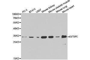 Western blot analysis of extracts of various cell lines, using IGFBP5 antibody. (IGFBP5 anticorps  (AA 21-272))