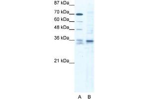 Human Jurkat; WB Suggested Anti-SOX12 Antibody. (SOX12 anticorps  (C-Term))