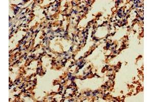 Immunohistochemistry of paraffin-embedded human lung tissue using ABIN7161677 at dilution of 1:100 (NOG anticorps  (AA 28-232))