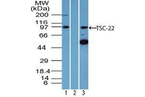 Image no. 1 for anti-TSC22 Domain Family, Member 1 (TSC22D1) (AA 100-150) antibody (ABIN960389) (TSC22D1 anticorps  (AA 100-150))