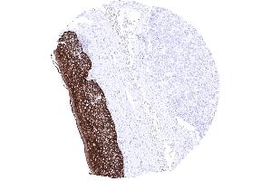 Tonsil surface Epithelium A strong KRT15 immunostaining is found in all cell layers of all non keratinizing and keratinizing squamous epithelium except keratin layer