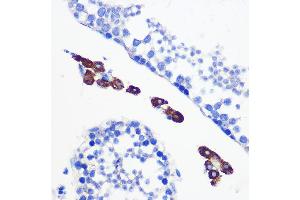 Immunohistochemistry of paraffin-embedded mouse testis using [KO Validated] Bax Rabbit mAb (ABIN7265855) at dilution of 1:100 (40x lens). (BAX anticorps)