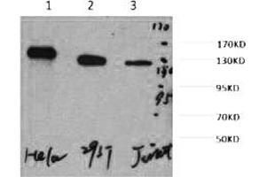 Western blot analysis of 1) Hela, 2) 293T, 3) Jurkat, diluted at 1:2000.