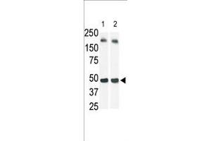 The anti-SphK1 Pab (ABIN391345 and ABIN2841366) is used in Western blot (Lane 2) to detect c-myc-tagged SphK1 in transfected 293 cell lysate (a c-myc antibody is used as control in Lane 1).