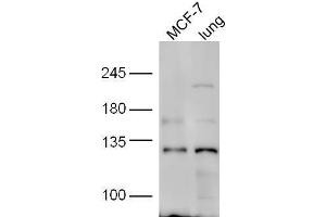 line1, MCF-7 lysate; line2,mouse lung lysate probed with Rabbit Anti-HNRPUL1 Polyclonal Antibody, Unconjugated  at 1:5000 for 90min at 37˚C. (HNRNPUL1 anticorps  (AA 701-800))