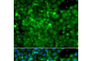 Immunofluorescence analysis of A549 cells using POC1A Polyclonal Antibody (POC1A anticorps)