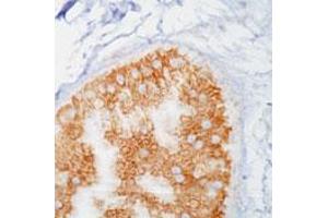 Immunohistochemistry (IHC) image for anti-Phosphotyrosine antibody (ABIN197635) (Phosphotyrosine anticorps)