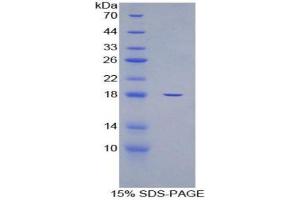 SDS-PAGE (SDS) image for Glyceraldehyde-3-Phosphate Dehydrogenase (GAPDH) (AA 2-148) protein (His tag) (ABIN1879236)