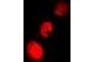 anti-Cofilin 2 (CFL2) antibody