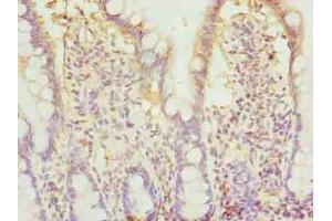Immunohistochemistry of paraffin-embedded human small intestine tissue using ABIN7145881 at dilution of 1:100