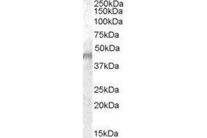 ABIN2563527 (0. (KCNJ11 anticorps  (Internal Region))