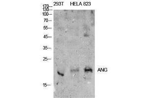 Western Blotting (WB) image for anti-Angiotensinogen (serpin Peptidase Inhibitor, Clade A, Member 8) (AGT) (Internal Region) antibody (ABIN3178889) (AGT anticorps  (Internal Region))
