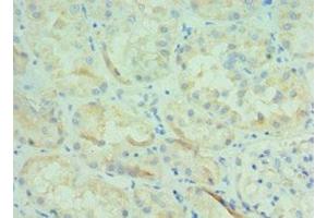 Immunohistochemistry of paraffin-embedded human kidney tissue using ABIN7145826 at dilution of 1:100 (BOC anticorps  (AA 1-125))