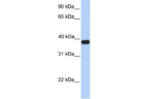 WB Suggested Anti-ASB5 Antibody Titration:  0. (ASB5 anticorps  (C-Term))
