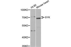 Western blot analysis of extracts of various cell lines, using SYK antibody (ABIN5971150) at 1/500 dilution. (SYK anticorps)