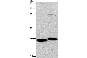 Western blot analysis of Mouse intestinum tenue and heart tissue, using CIDEC Polyclonal Antibody at dilution of 1:551