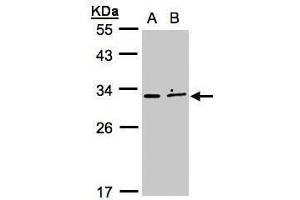 WB Image Sample (30μg whole cell lysate) A:MOLT4 , B:Raji , 12% SDS PAGE antibody diluted at 1:500 (XRCC2 anticorps)