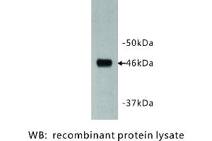 Image no. 1 for anti-Dachsous 1 (DCHS1) antibody (ABIN1112924) (DCHS1 anticorps)