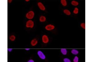 Confocal immunofluorescence analysis of U2OS cells using KU70 Polyclonal Antibody at dilution of 1:100.